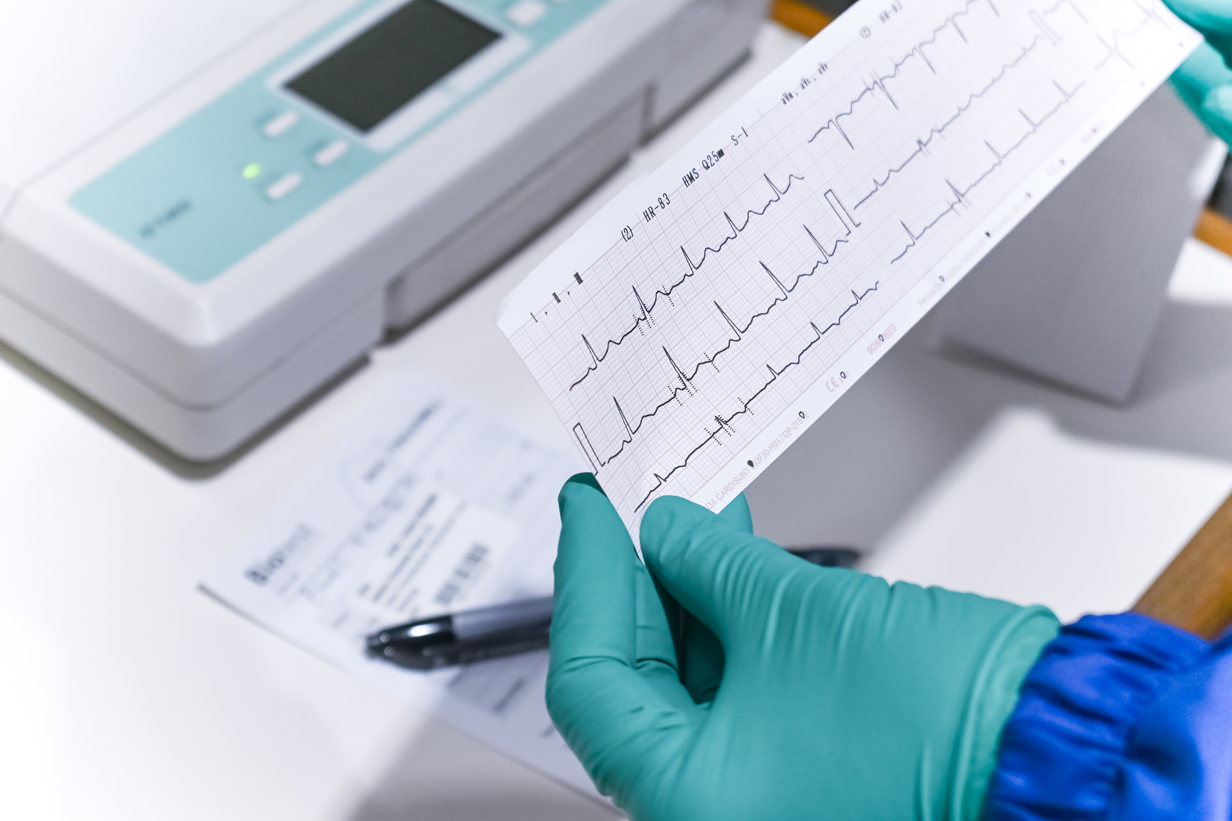 ekg